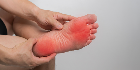 Choosing the Right Arch Support for Your Foot Type