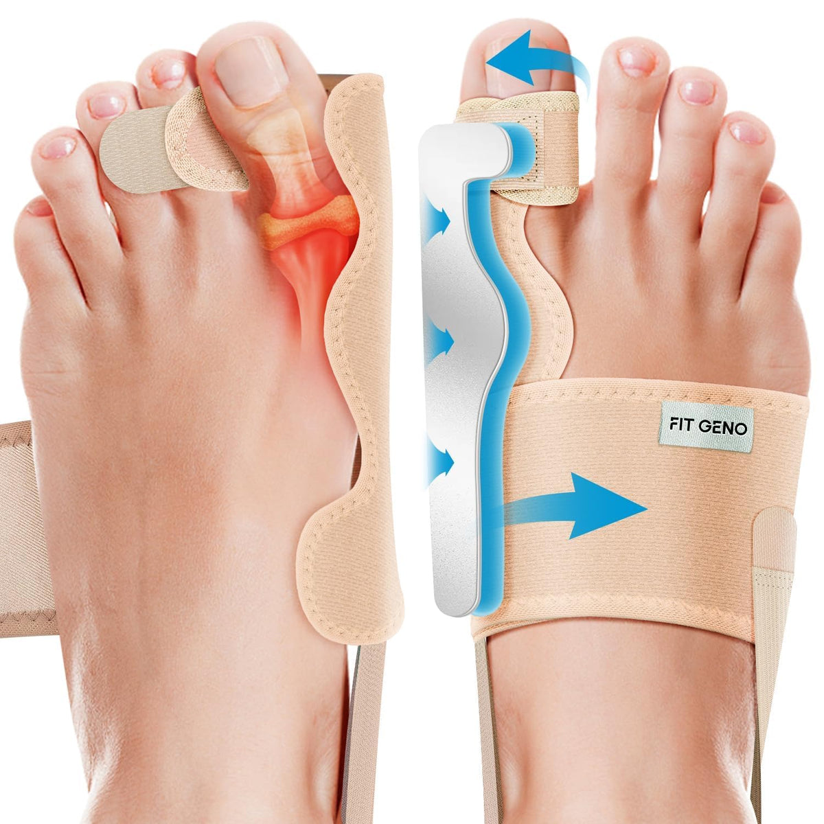 Fit Geno Bunion Corrector - Beige