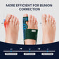 Fit Geno Bunion Corrector big toe alignment support