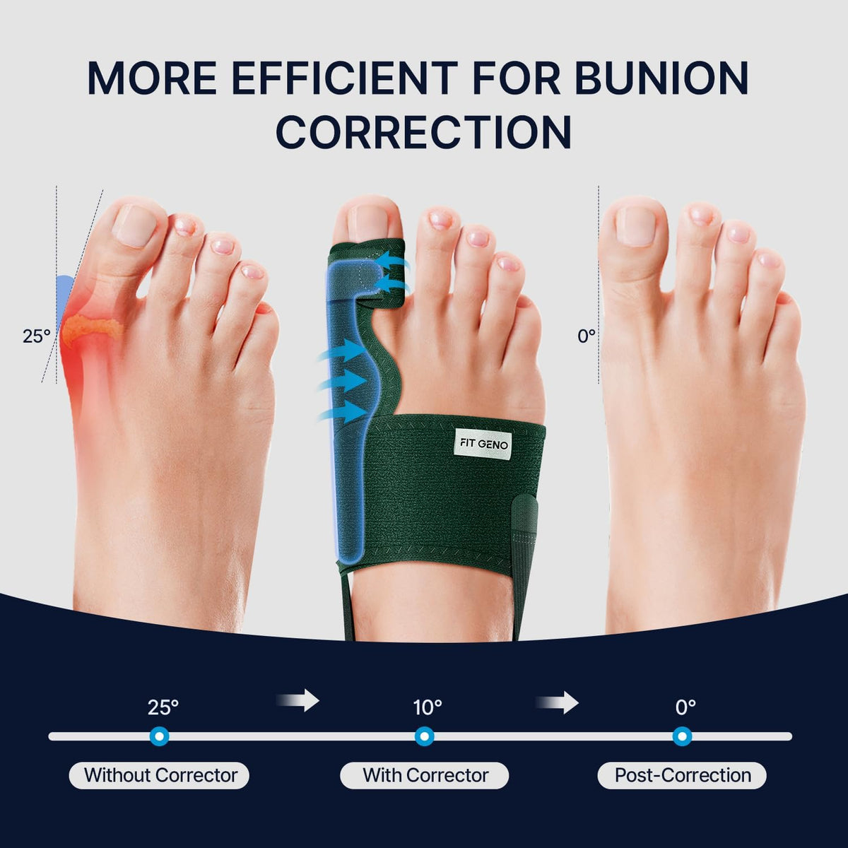 Fit Geno Bunion Corrector big toe alignment support