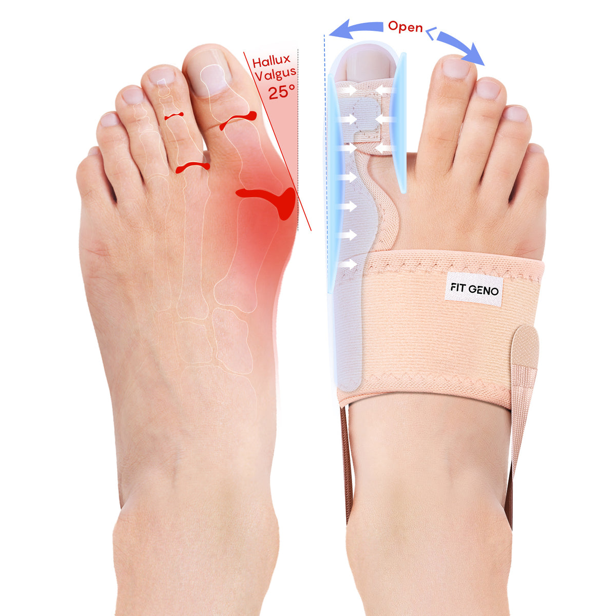 Bunion Corrector