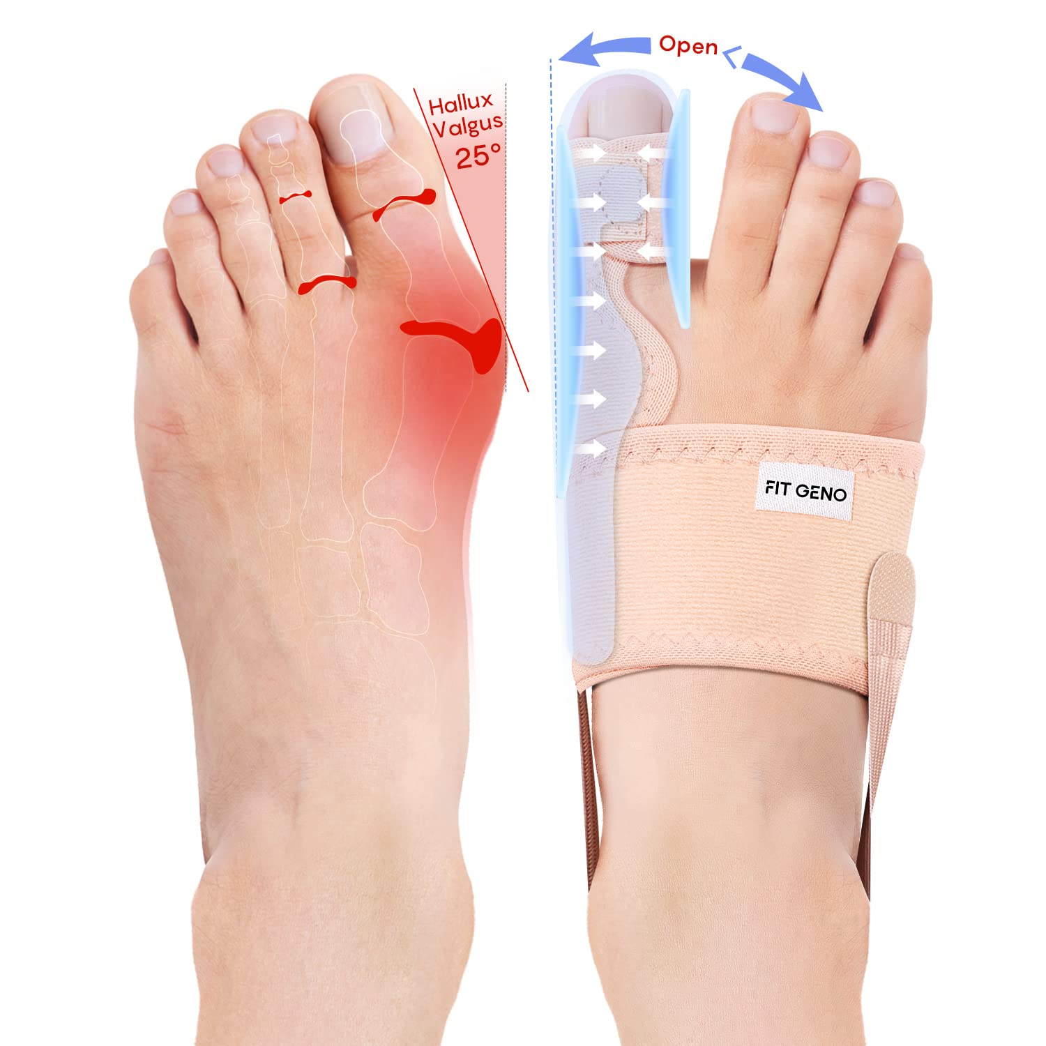No more bunion discomfort with Fitgeno's incredible bunion