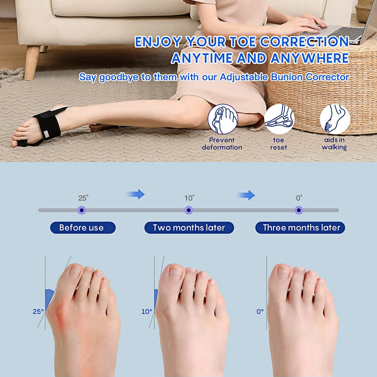 Bunion Corrector